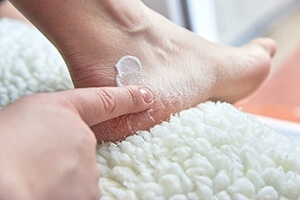 What to Do for Cracked Heels
