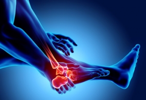 Treatments for Cuboid Syndrome