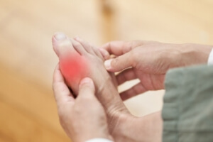 Common Symptoms of Gout
