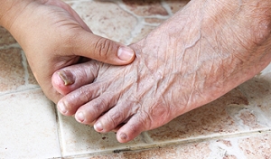 Toenail Fungus Prevention