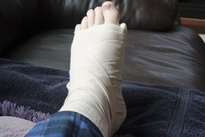 Causes and Symptoms of a Broken Foot
