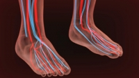 Do Symptoms Always Appear With Peripheral Artery Disease?