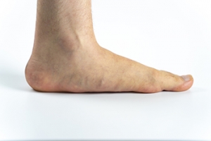 Flat Feet and the Military